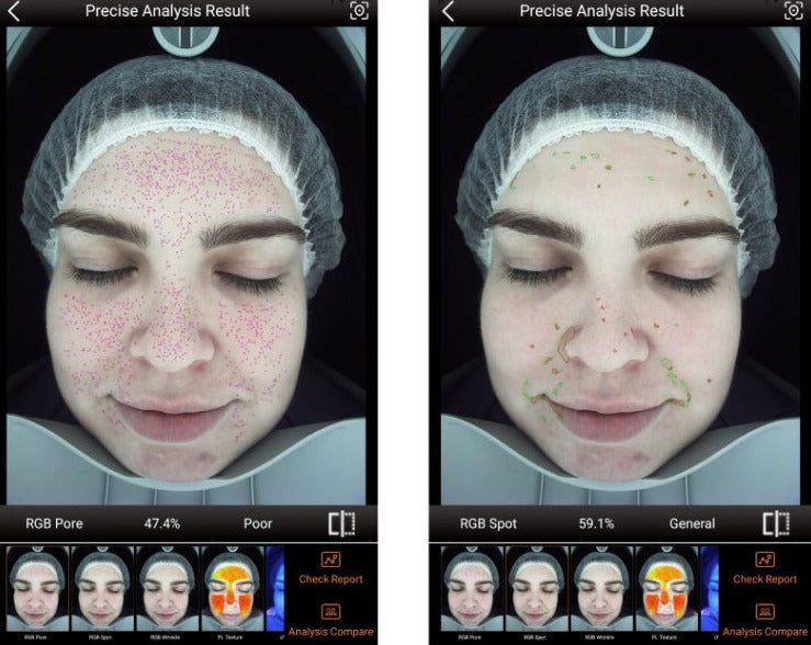 Zemits VeraFace Sistema de Análisis de Piel