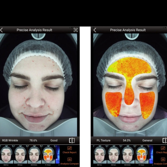 Zemits VeraFace Sistema de Análisis de Piel