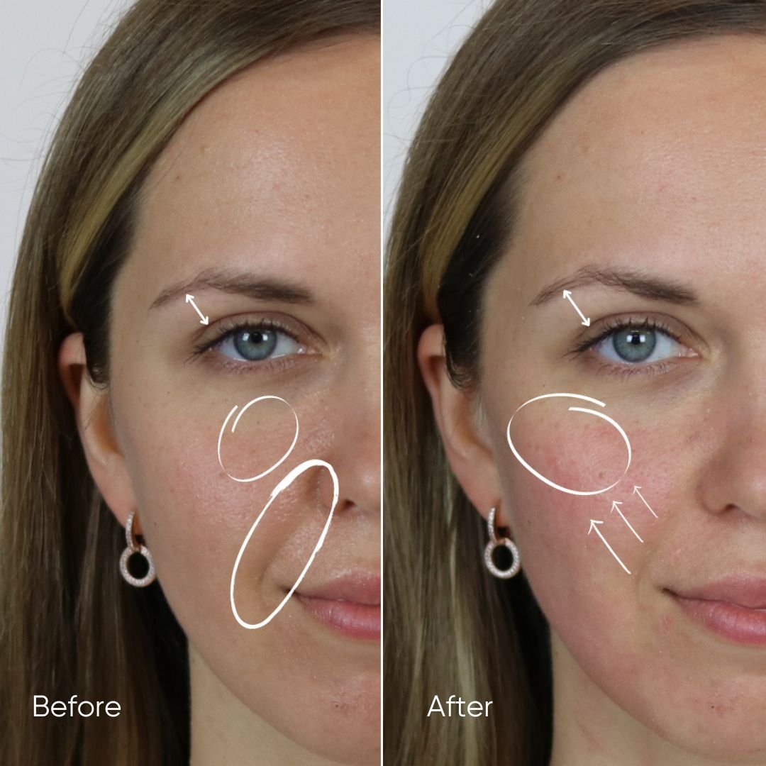 Zemits HydroVerstand PRO Sistema 7-en-1 HydroDiamond™